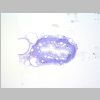 Ureter 01.jpg